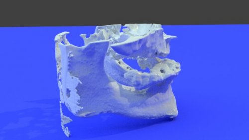 Implant demo - stl file processed - Dental, Orthodontic, Maxillofacial ...