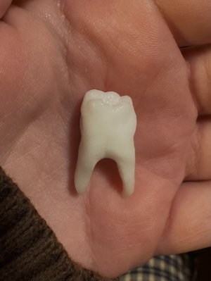Glass tooth by Amanda Grunloh (2025-2026)