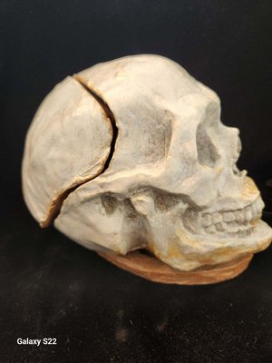 Need a dentist...side view by lisa toohey (2024)