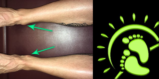 supine short leg check up left leg short