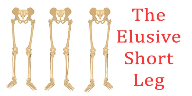 The Elusive Short Leg - 3 different pics - short leg right, normal, short leg left