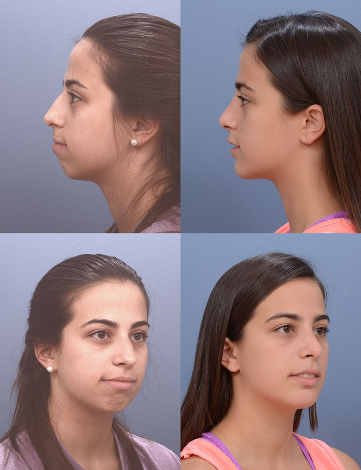 plastic surgeon Tampa 