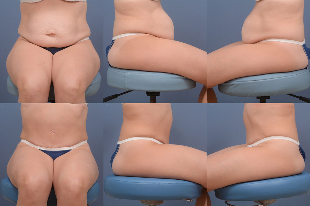 cosmetic surgery in Tampa FL