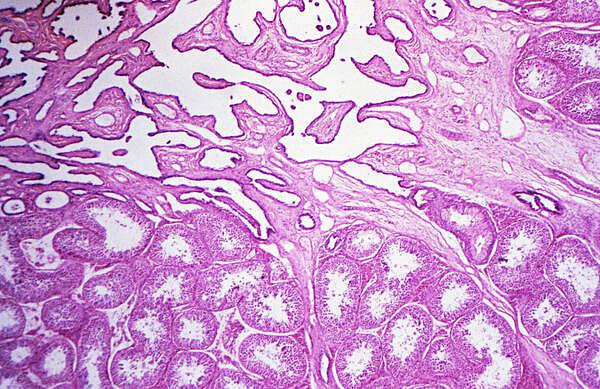 The Role and Impact of Pathology in Modern Medicine