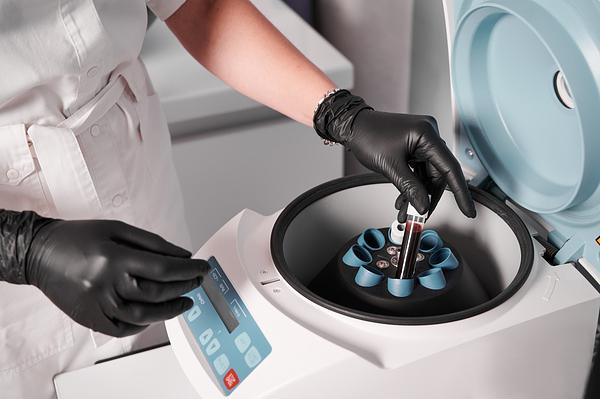 Beyond the Test Tube Exploring the Fascinating World of Analyzers