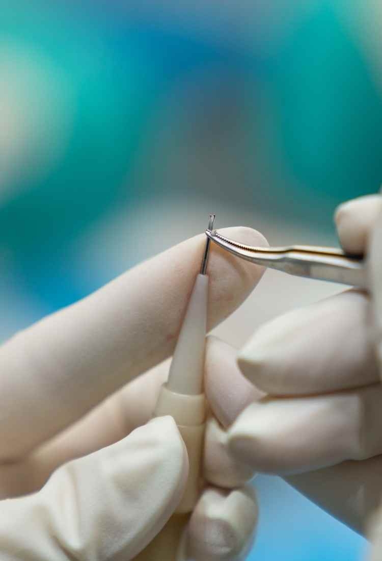 How is Heva Clinic’s approach to hair transplants innovative?