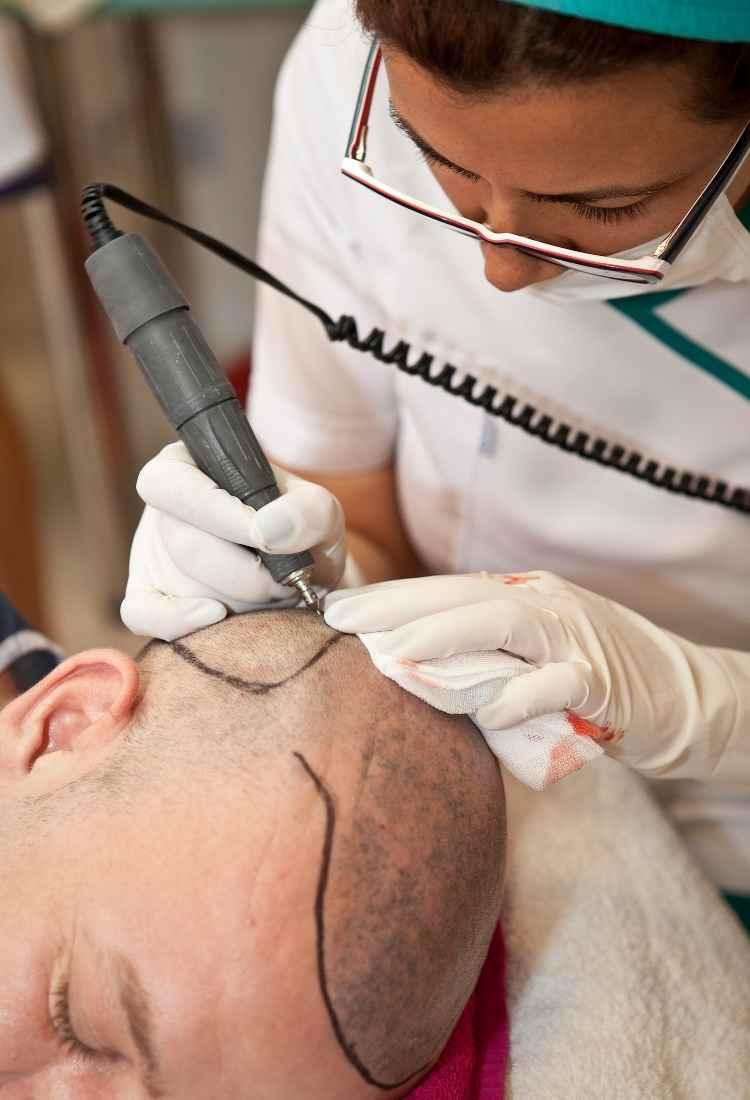 CM Hair Clinic: Leading Hair Transplant Clinic in Punta Cana