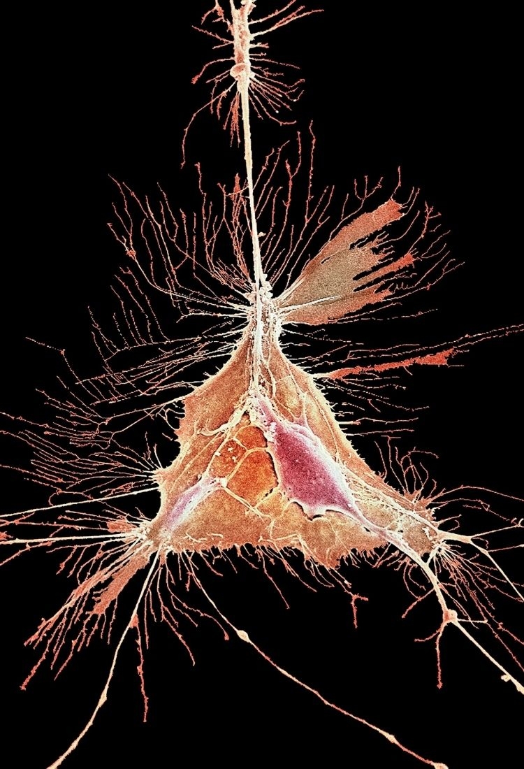 Premier Hair Transplant Clinics: Your Guide to Global Options