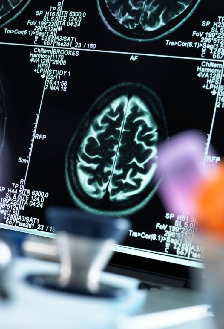 Hair Loss Treatments at Seneca Hair Transplant Clinic in Greece