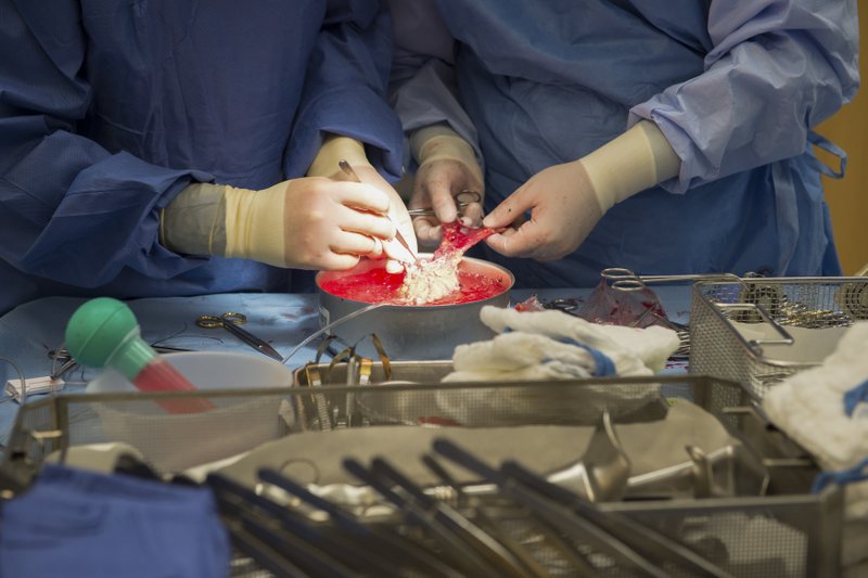 Trump revamps kidney care to spur transplants, home dialysis | FACTSWANTED