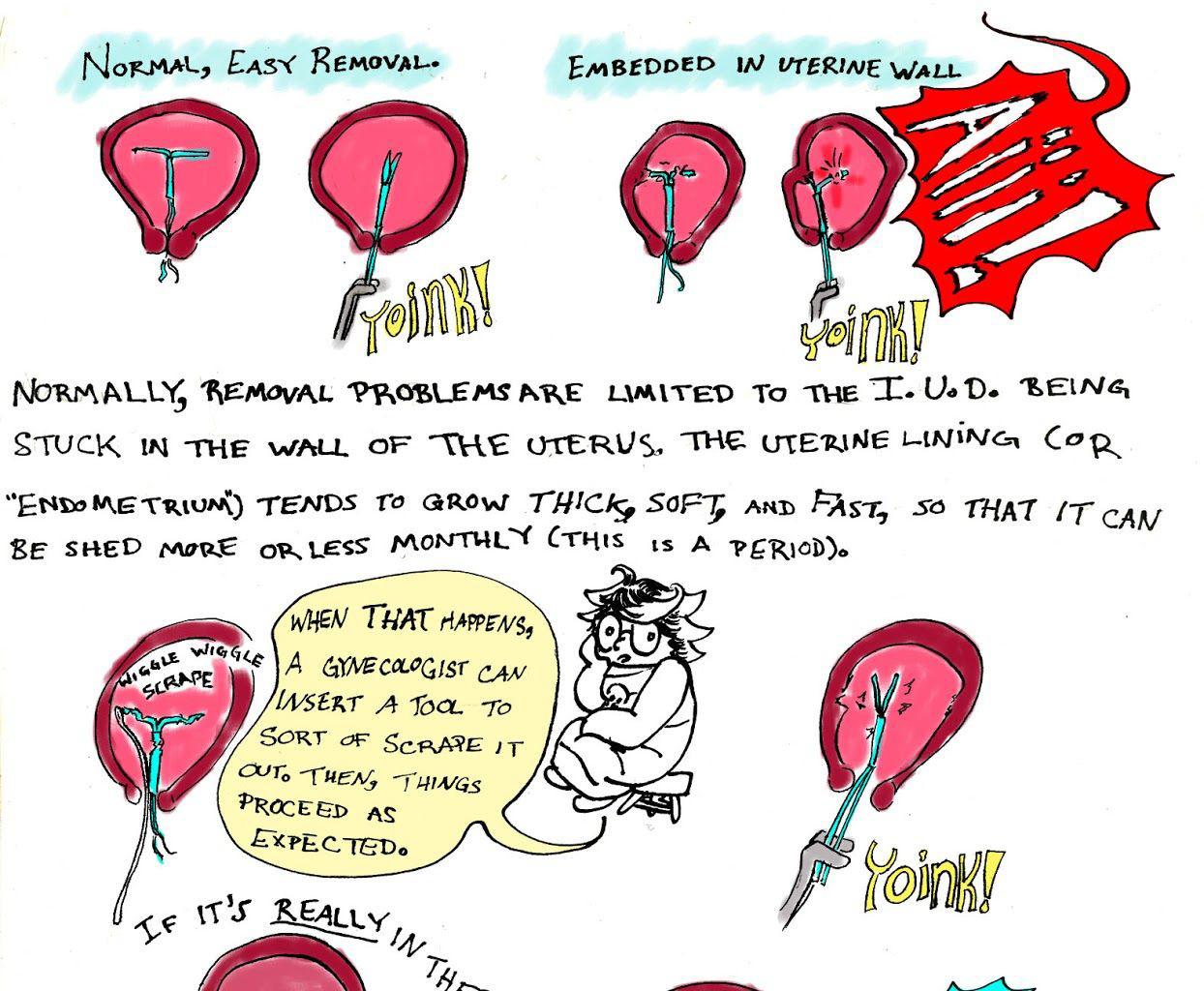 Family Lore - Episode 2, Page 6: Julia's Intra-Uterine Device