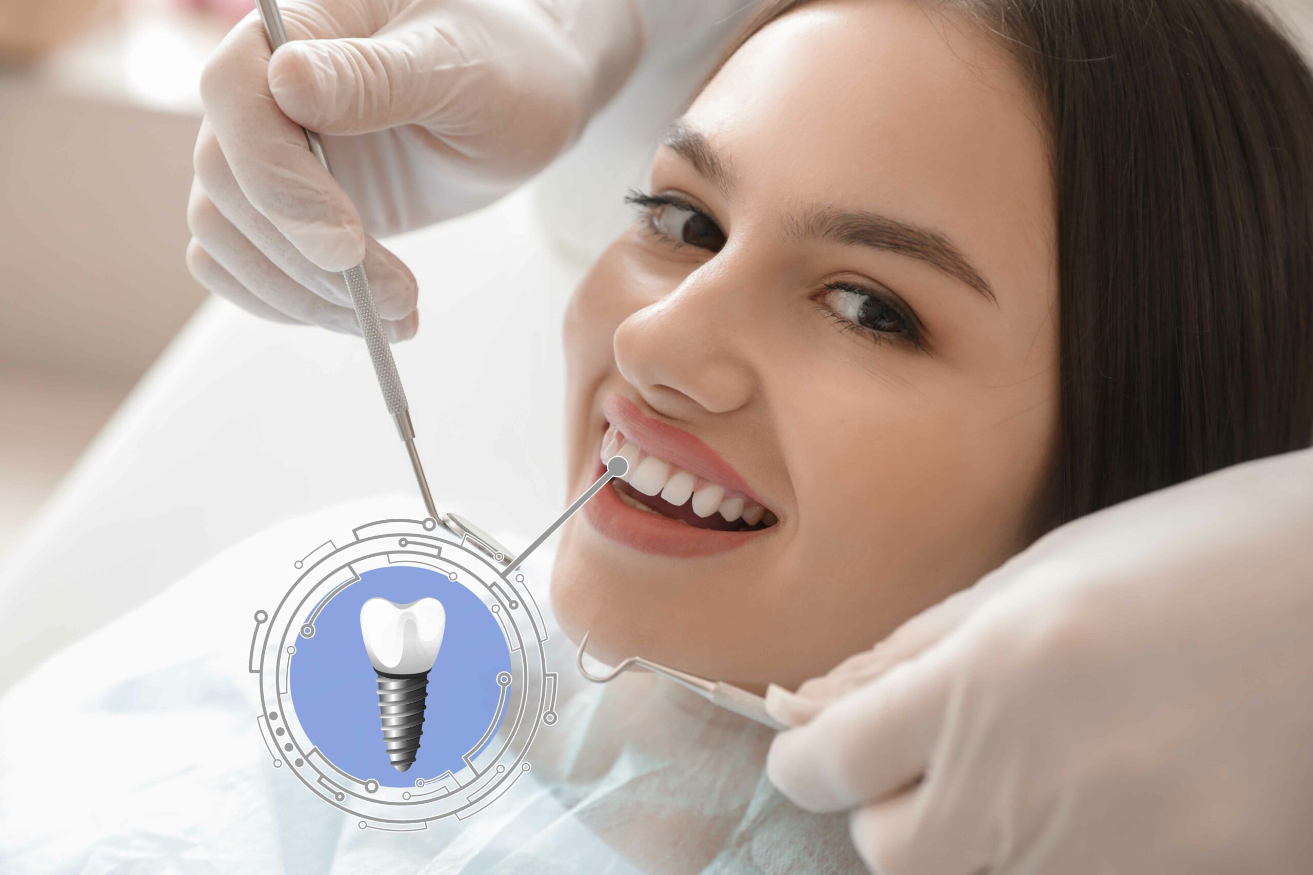 How Dental Implants Contribute to Long-Term Oral Health