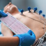 Comprehensive Guide to Echocardiography Testing Services in Bangalore: What to Expect & How It Helps
