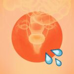 Urinary Incontinence: Causes, Leakage, Types & Treatment