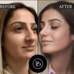 Best Aesthetic Clinics in Dubai Offering Botox, Fillers, and More