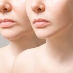 Advancements in Anti-Aging Treatments
