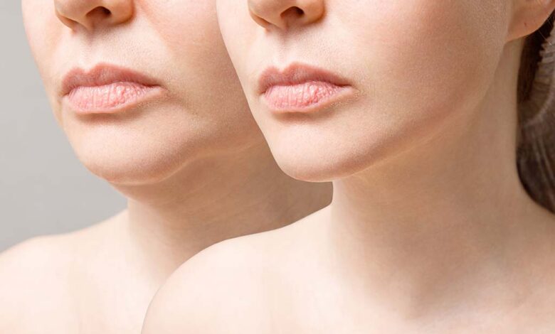 Advancements in Anti-Aging Treatments