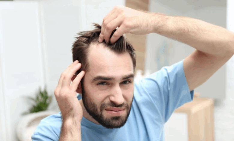 How to Use Hair Medicine Effectively: A Men’s Guide to Faster Results