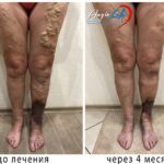 Comprehensive Vascular Health Solutions in Ukraine