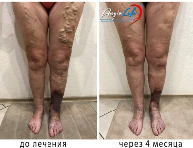 Comprehensive Vascular Health Solutions in Ukraine