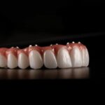Building Trust Through Quality Smile Services in Stockport