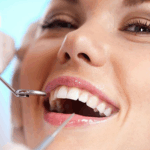 Permanent Dentures in Tampa: A Comprehensive Guide