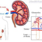 Recognizing Kidney Issues and Taking Steps Toward Wellness