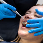 Where to Find the Most Accurate Denturists Email List?