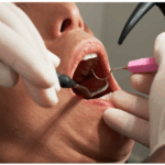 What to Look for When Choosing the Right Family Dentist for Long-Term Care