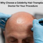 Why Choose a Celebrity Hair Transplant Doctor for Your Procedure
