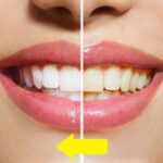 Factors That Influence the Price of Cosmetic Dental Work