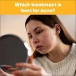 Skin Treatment in Delhi – Advanced Care at Aayna Clinic