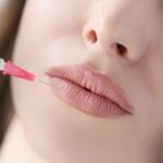 Transform Your Look with Pink Lips Laser Treatment Smooth Finish