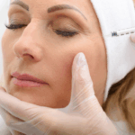 Fast Acting Botox Treatment for Fine Lines and Age Defying Beauty