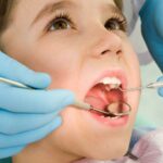 Looking for Dental Veneers in Diamond Bar? Expert Cosmetic Solutions & More