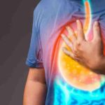 Heartburn Treatment in Dubai: Causes, Symptoms, and Care Tips
