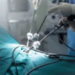 Understanding Laparoscopic Surgery Options Available in Dubai