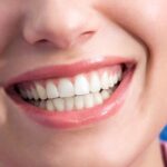 Smile Makeovers in Leeds: What Your Dentist Can Do for You