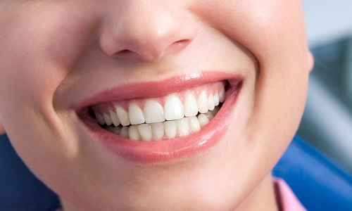 Smile Makeovers in Leeds: What Your Dentist Can Do for You Smile Makeovers in Leeds: What Your Dentist Can Do for You
