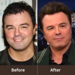 Seth MacFarlane Plastic Surgery: Separating Fact from Speculation