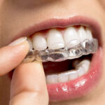 Clear Smiles Ahead: Discovering the Benefits of an Invisalign Provider Hillsdale