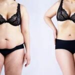 Transform Your Confidence with a Tummy Tuck in Bangalore at Aesthetic International