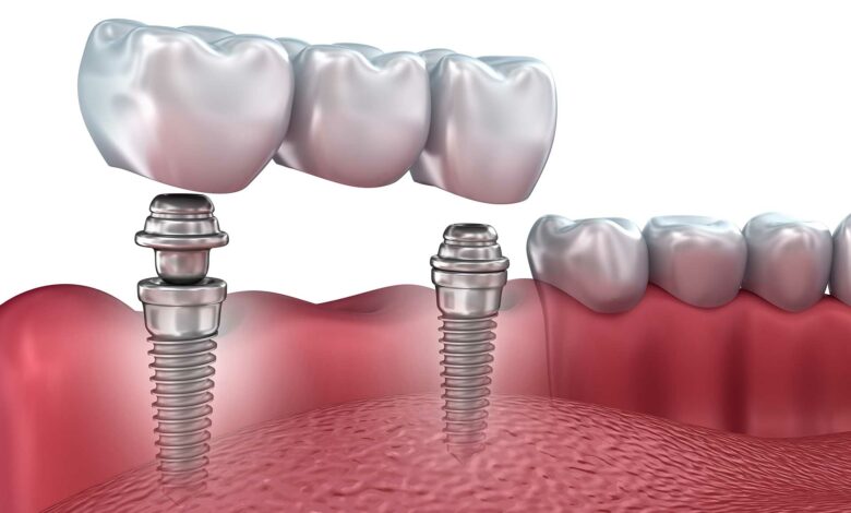 How Affordable Are Dental Services at Smile NYC?