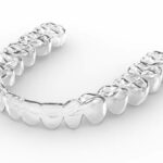 Why More Adults Are Choosing Invisalign in Fort Collins for Straighter Teeth