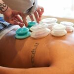 Cupping Therapy in Philadelphia: A Modern Take on an Ancient Practice