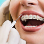 Getting to a forever better with professional braces care