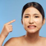 Discover The Best Acne Treatment For Lasting Clear Skin
