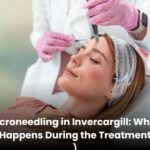 Microneedling in Invercargill: What Happens During the Treatment