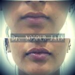 Healthy, Confident & Naturally Radiant Skin with Skin Zest