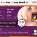 2025–2030 Contact Lens Market Report: Innovation, Drivers & Challenges
